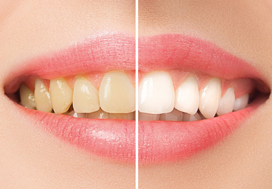 Cosmetic Dentistry