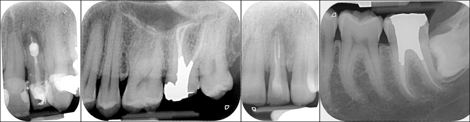 For Dentists